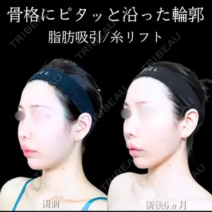 アリエル美容クリニック 大宮院 江郷隼一郎医師の症例