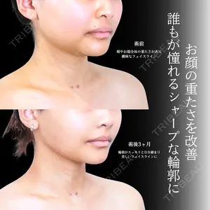 アリエル美容クリニック 横浜院 渡邉 光医師の症例