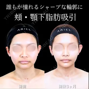 アリエル美容クリニック 横浜院 渡邉 光医師の症例