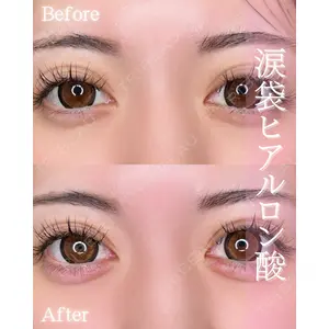ルラ美容クリニック 大阪本院 平田 一記医師の症例