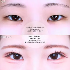 アリエル美容クリニック 水戸院 天白 典秀医師の症例