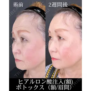 HAAB×DREAM BEAUTY CLINIC 大阪梅田院 柏木 太雅医師の症例