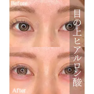 ルラ美容クリニック 大阪本院 平田 一記医師の症例