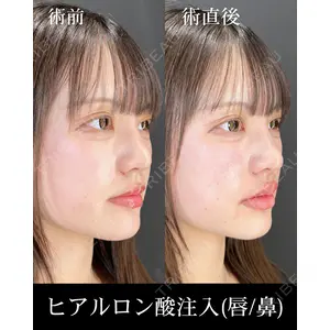HAAB×DREAM BEAUTY CLINIC 大阪梅田院 柏木 太雅医師の症例