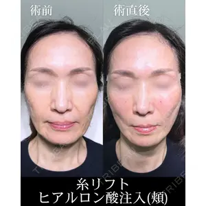 HAAB×DREAM BEAUTY CLINIC 大阪梅田院 柏木 太雅医師の症例