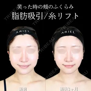 アリエル美容クリニック 大宮院 鈴木　桂介医師の症例