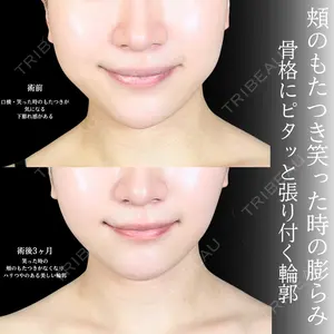 アリエル美容クリニック 大宮院 鈴木　桂介医師の症例