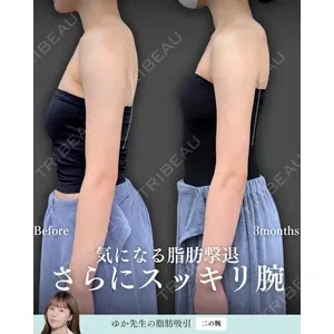 東京シンデレラ美容外科 新宿院 宮﨑友伽医師の症例