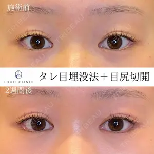 LOUIS CLINIC 二子玉川院【ルイクリニック】 小松 塁医師の症例