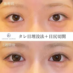 LOUIS CLINIC 二子玉川院【ルイクリニック】 小松 塁医師の症例