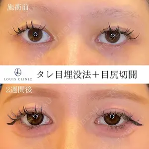 LOUIS CLINIC 二子玉川院【ルイクリニック】 小松 塁医師の症例
