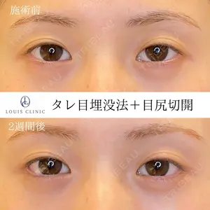 LOUIS CLINIC 二子玉川院【ルイクリニック】 小松 塁医師の症例