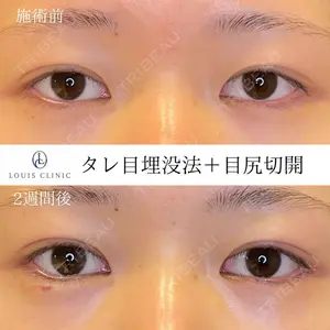 LOUIS CLINIC 二子玉川院【ルイクリニック】 小松 塁医師の症例