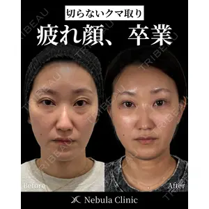 愛知春日井美容外科ネビュラクリニック 都築 諒医師の症例