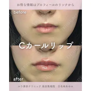 ルラ美容クリニック 高田馬場院 日名地 あゆみ医師の症例