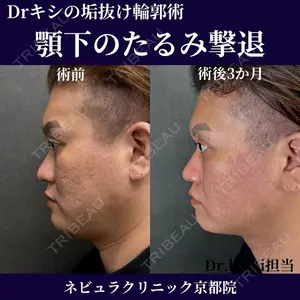 ネビュラクリニック 京都院 岸 大輔医師の症例