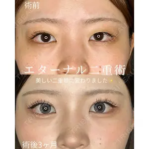 ルラ美容クリニック 仙台院 / ルラスキンクリニック 仙台院 橋本 英樹医師の症例