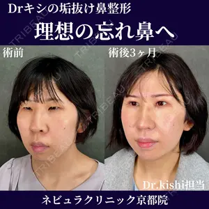 ネビュラクリニック 京都院 岸 大輔医師の症例