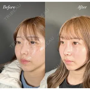 R Beauty CLINIC 名古屋院 木村 尚大医師の症例