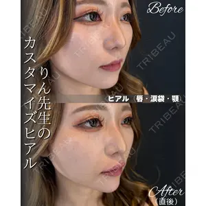 HAAB BEAUTY CLINIC 南青山本院（新院） 桂田 凛医師の症例