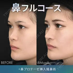 ジョウクリニック 銀座院 重本　譲医師の症例
