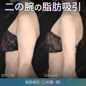 ジョウクリニック 銀座院 重本　譲医師の症例
