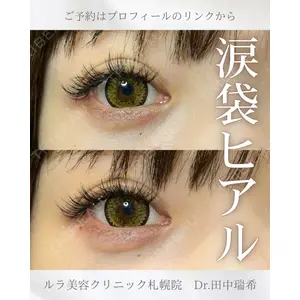 ルラ美容クリニック 札幌本院 田中 瑞希医師の症例