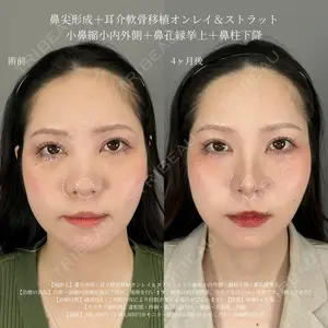 ASTRA BEAUTY CLINIC 塩満 惠子医師の症例