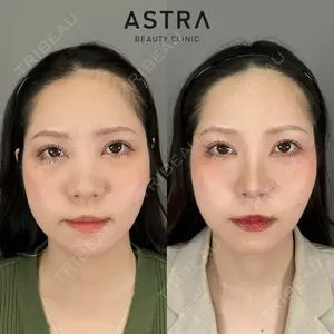 ASTRA BEAUTY CLINIC 塩満 惠子医師の症例