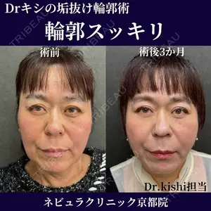 ネビュラクリニック 京都院 岸 大輔医師の症例