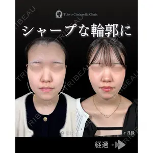 東京シンデレラ美容外科 池袋院 石井 達也医師の症例