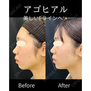 ルラ美容クリニック 仙台院 / ルラスキンクリニック 仙台院 橋本 英樹医師の症例