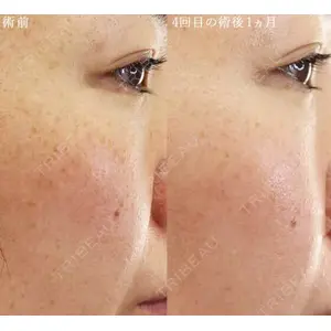 大阪TAクリニックの症例