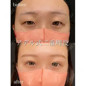 アデル美容クリニックの症例