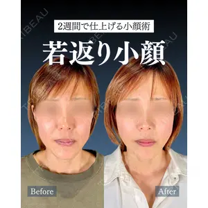 神戸美容外科 ネビュラクリニック 岩﨑 雅医師の症例