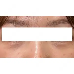 Ledian Clinic六本木 奥村 瞬医師の症例