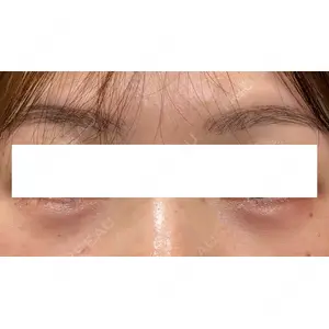 Ledian Clinic六本木 奥村 瞬医師の症例