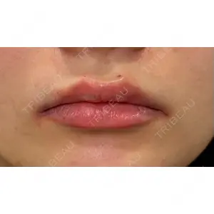 Ledian Clinic六本木の症例