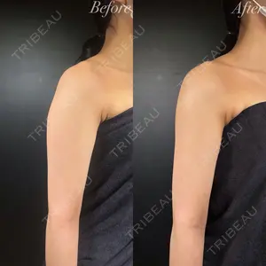 R Beauty CLINIC 銀座院 岩本　昌樹医師の症例