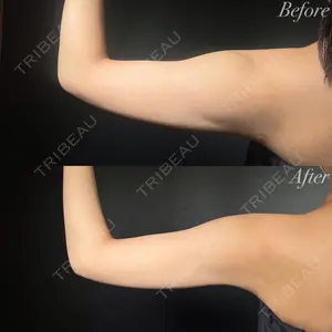 R Beauty CLINIC 銀座院 岩本　昌樹医師の症例