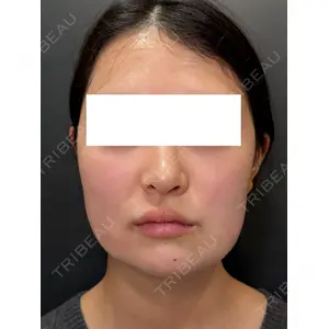 Ledian Clinic六本木 奥村 瞬医師の症例