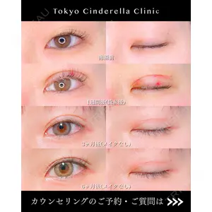東京シンデレラ美容外科 大宮院 竹田 昌平医師の症例