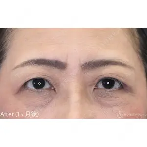 聖心美容クリニック 福岡院 美原 寿之医師の症例
