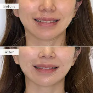nico wellness デンタルクリニック広尾 佐藤 大晟医師の症例