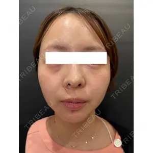 Ledian Clinic六本木 奥村 瞬医師の症例