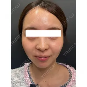 Ledian Clinic六本木 奥村 瞬医師の症例