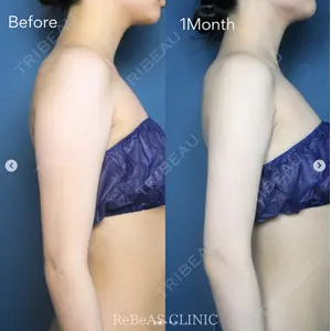 ReBeAS CLINICの症例