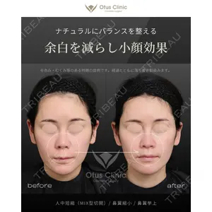 Otus Clinic 【オータスクリニック】 中 徳太郎医師の症例