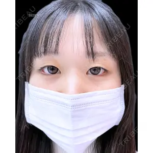 ルラ美容クリニック 高田馬場院 日名地 あゆみ医師の症例