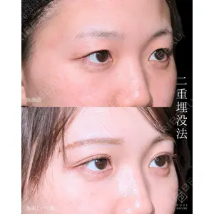 藤・ナチュレ美容クリニック 銀座院 小川 杏平医師の症例